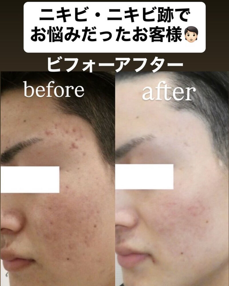 画像2462
