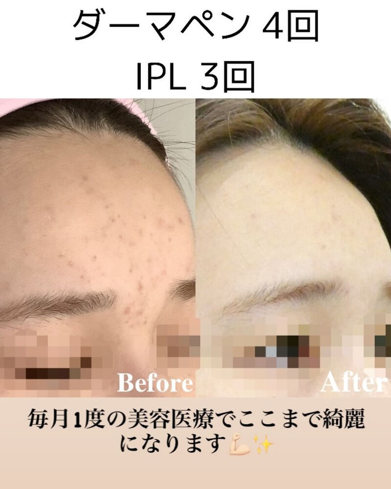 画像2487