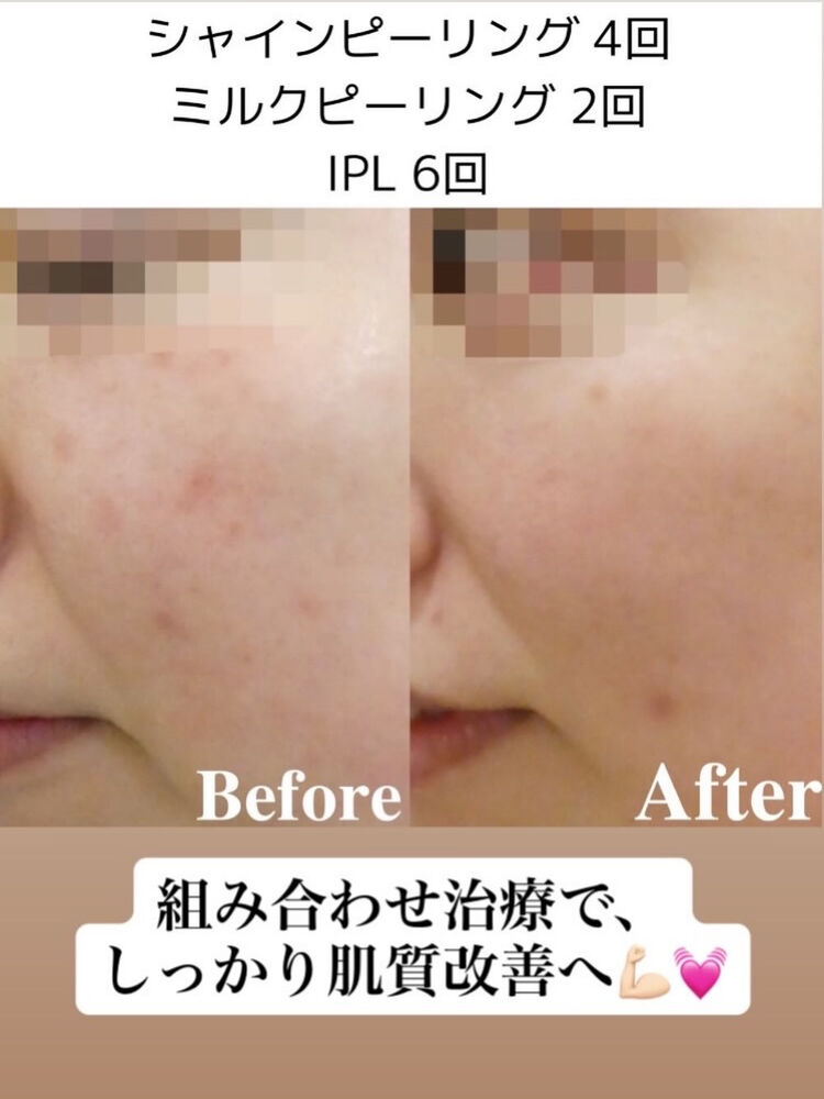 画像2503
