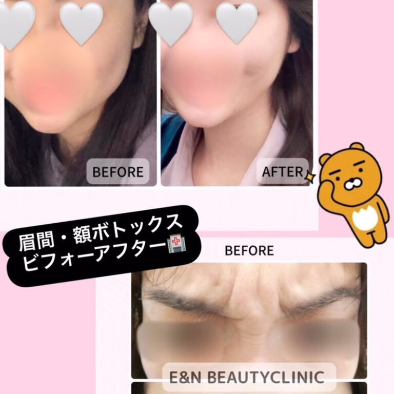 画像2540