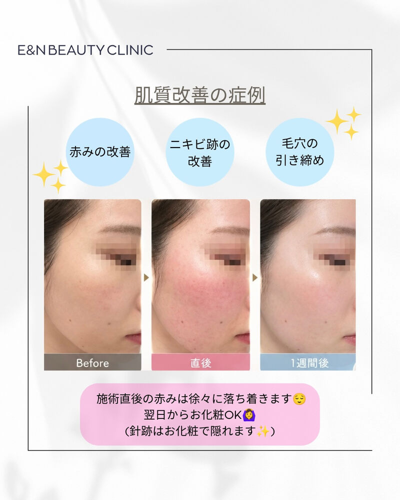 画像2572
