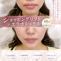 画像2593