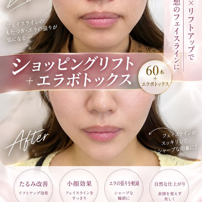 画像2593