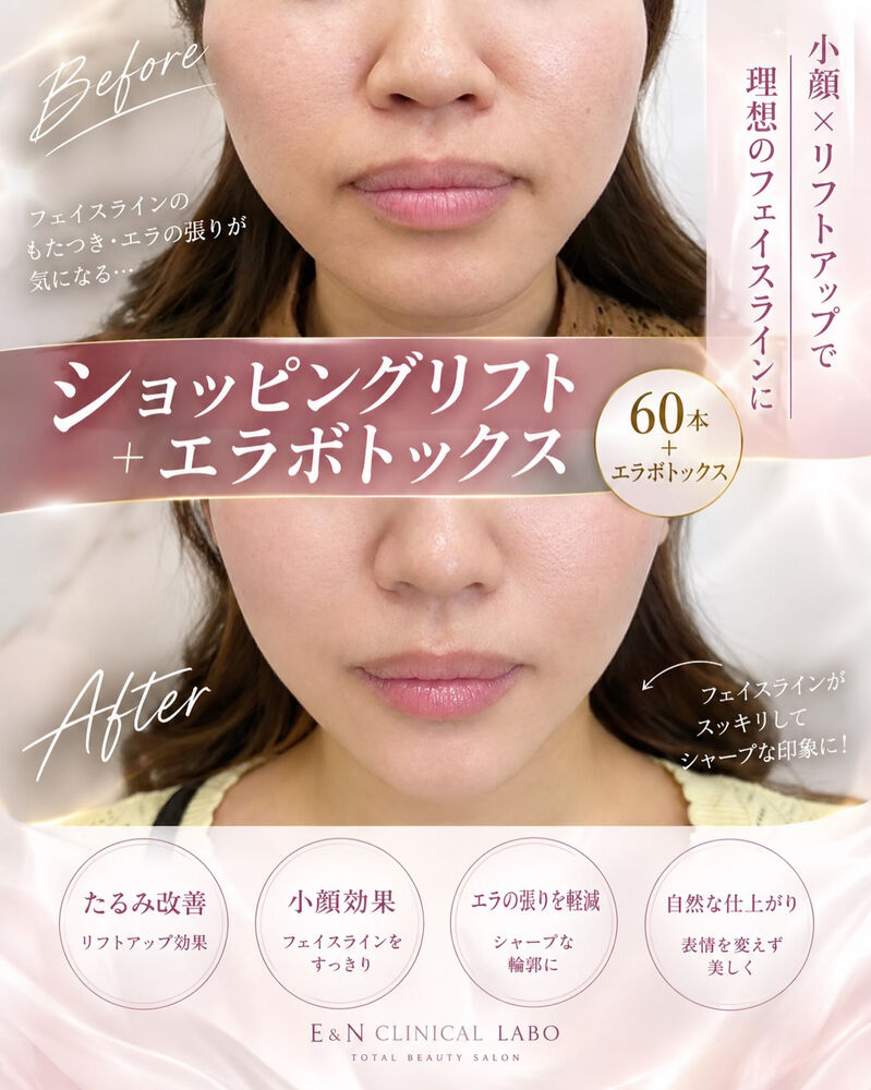 画像2593