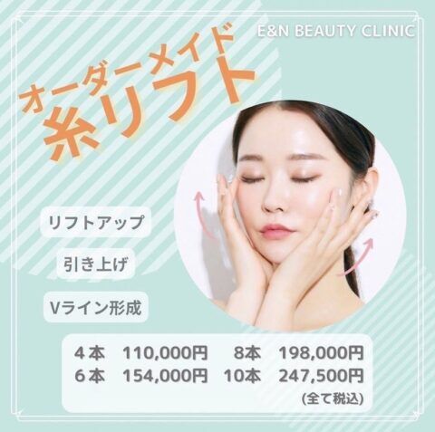 糸リフト